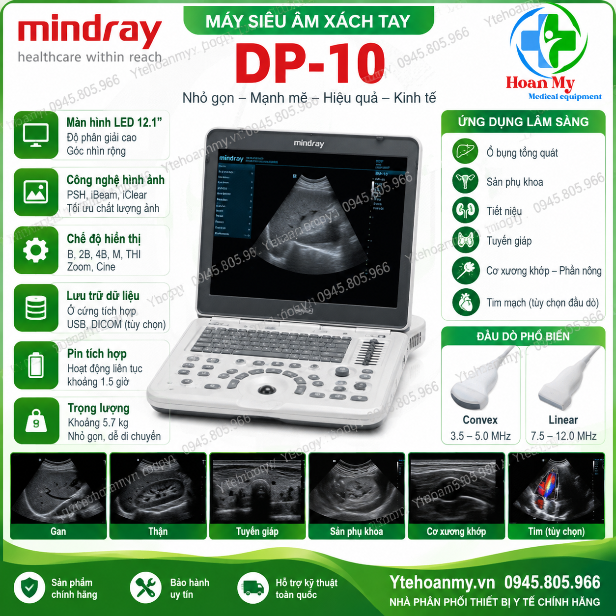 Bảng gi&aacute; m&aacute;y si&ecirc;u &acirc;m x&aacute;ch tay cập nhật mới nhất - SonoScape, VINNO, Mindray, Chison, Dawei
